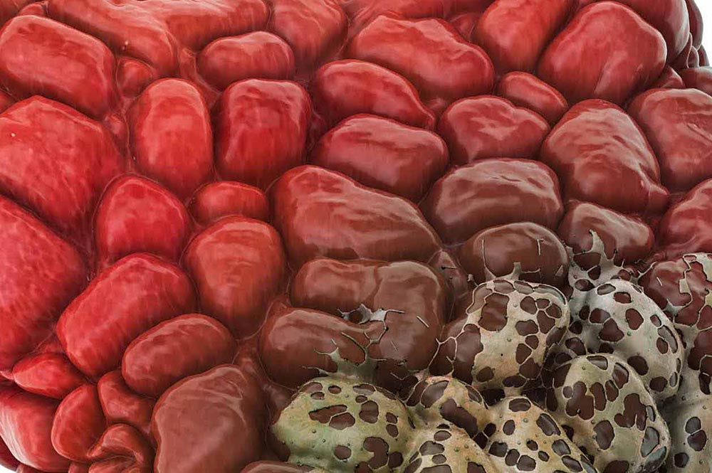 izboklina_ščitnica